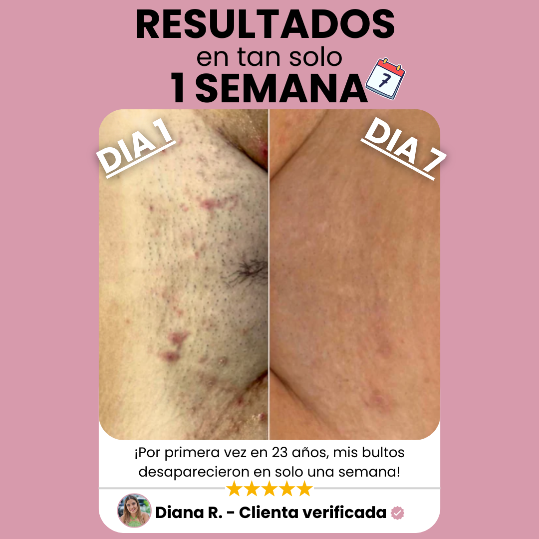 Sheely SafeSkin - Suavidad Real Sin Cortes