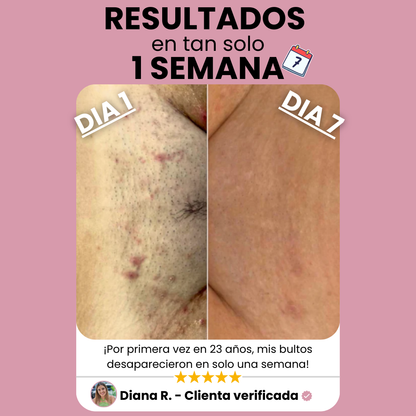 Sheely SafeSkin - Suavidad Real Sin Cortes