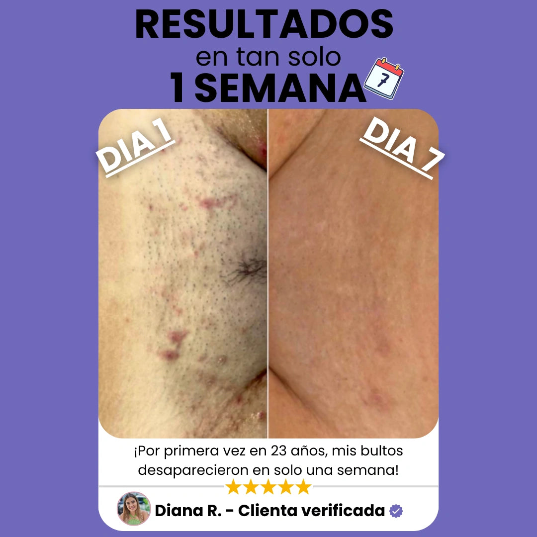 Sheely SafeSkin - Suavidad Real Sin Cortes