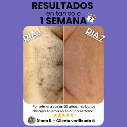 Sheely SafeSkin - Suavidad Real Sin Cortes