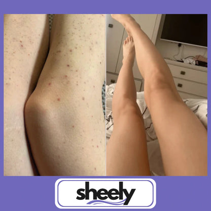 Sheely SafeSkin - Suavidad Real Sin Cortes