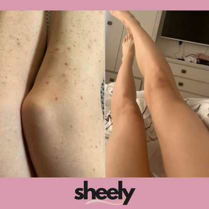 Sheely SafeSkin - Suavidad Real Sin Cortes