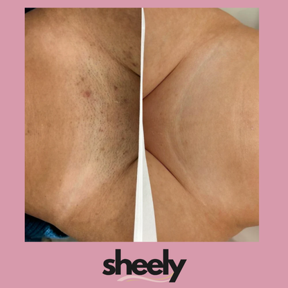 Sheely SafeSkin - Suavidad Real Sin Cortes