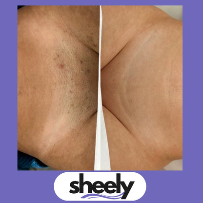 Sheely SafeSkin - Suavidad Real Sin Cortes